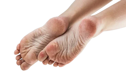 Richtige Fußpflege – So bleiben deine Füße gesund und schön