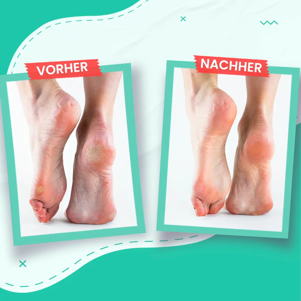 Fußcreme Für Trockene & Rissige Haut - ROSAMIX DE